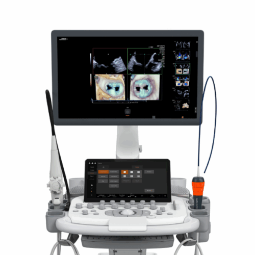 Acuson Venezuela ultrasonido Siemens Healthineers equipos médicos de ultrasonido ecografía avanzada en Venezuela ultrasonido para radiología, ginecología y cardiología