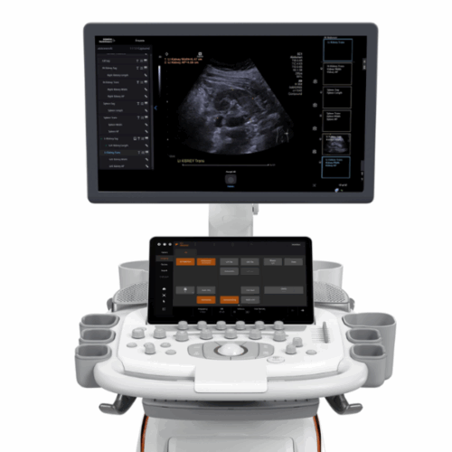 Acuson Sequoia Venezuela ultrasonido premium Siemens ecografía avanzada en Venezuela equipos médicos de diagnóstico por imagen ultrasonido de alta resolución para hospitales y clínicas